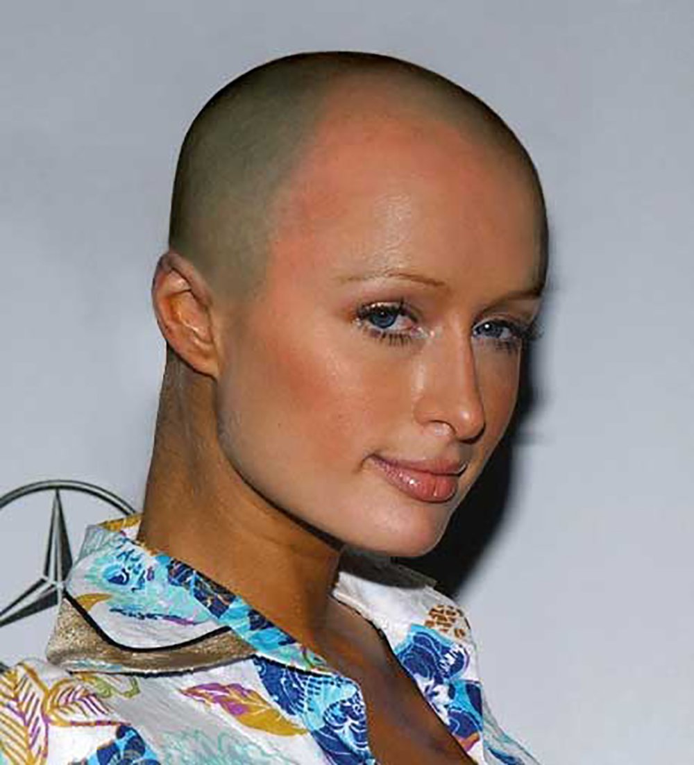 Лысая мужская голова