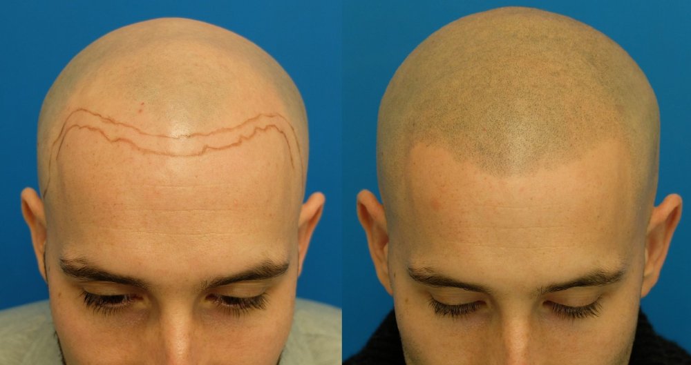 Камерон Диаз лысая